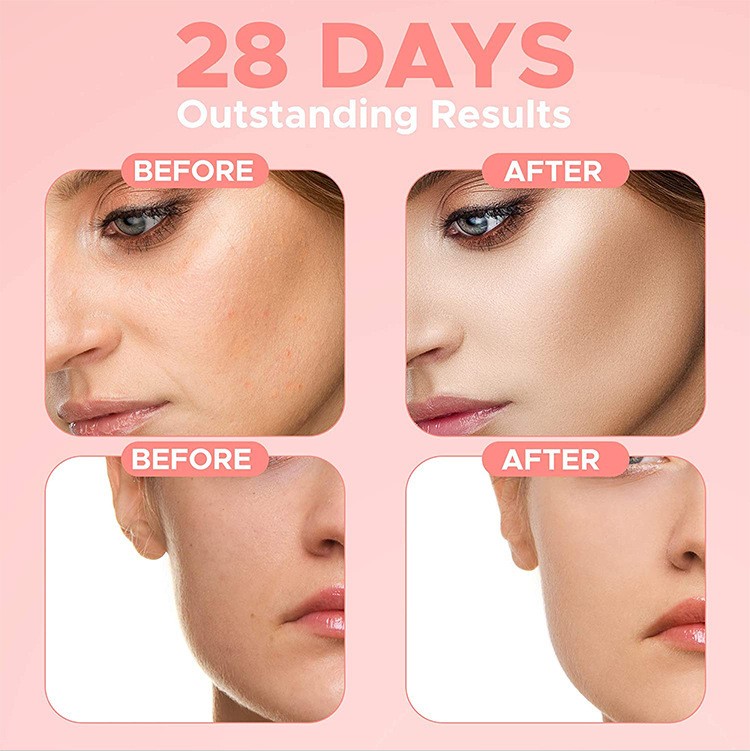 Advence Skin Care