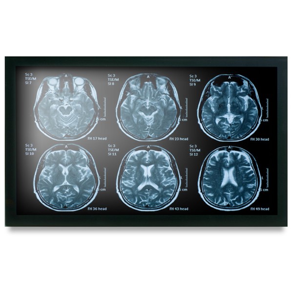 Onyx MEDDP-622HPN 21.5" Medical Touch Display