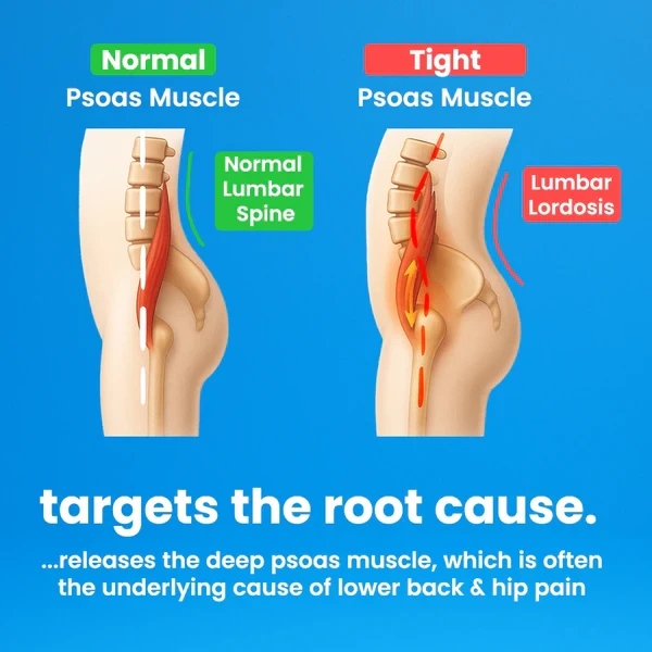 Capabody Psoas Peak