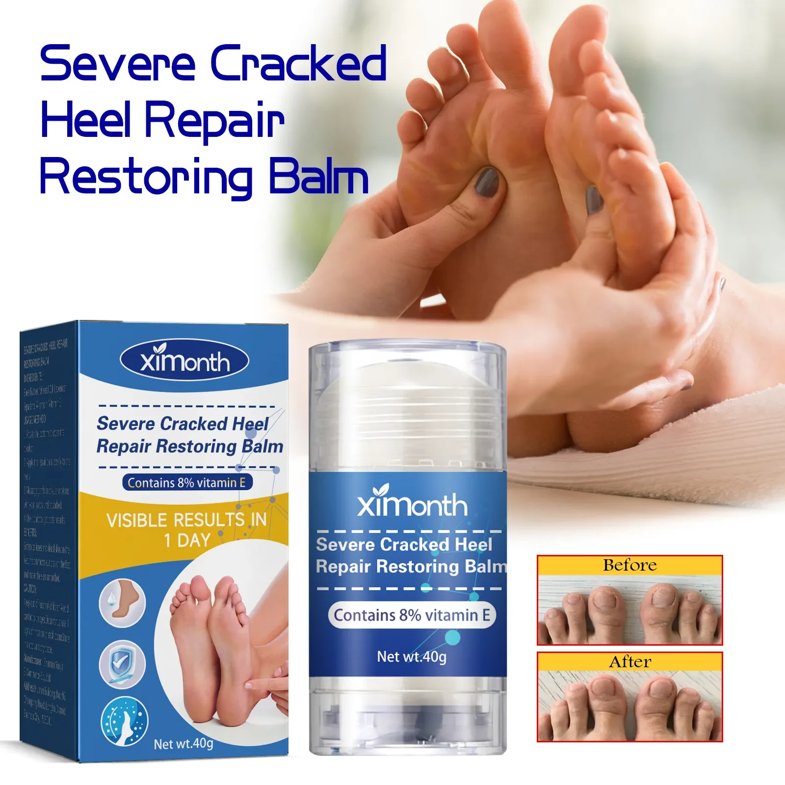 Moisturizing Heel Repair Cream Anti-heel Crack Peeling Dry