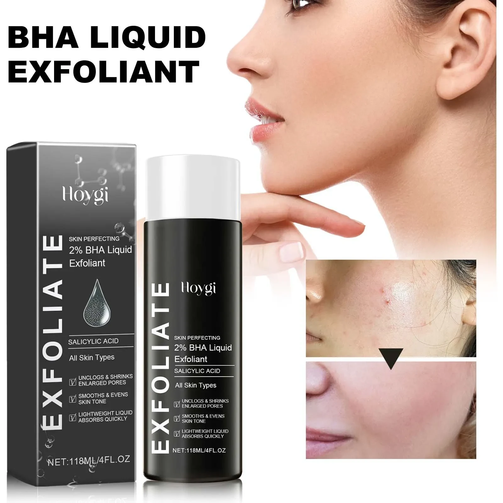 Hoygi 2% BHA Liquid Exfoliant