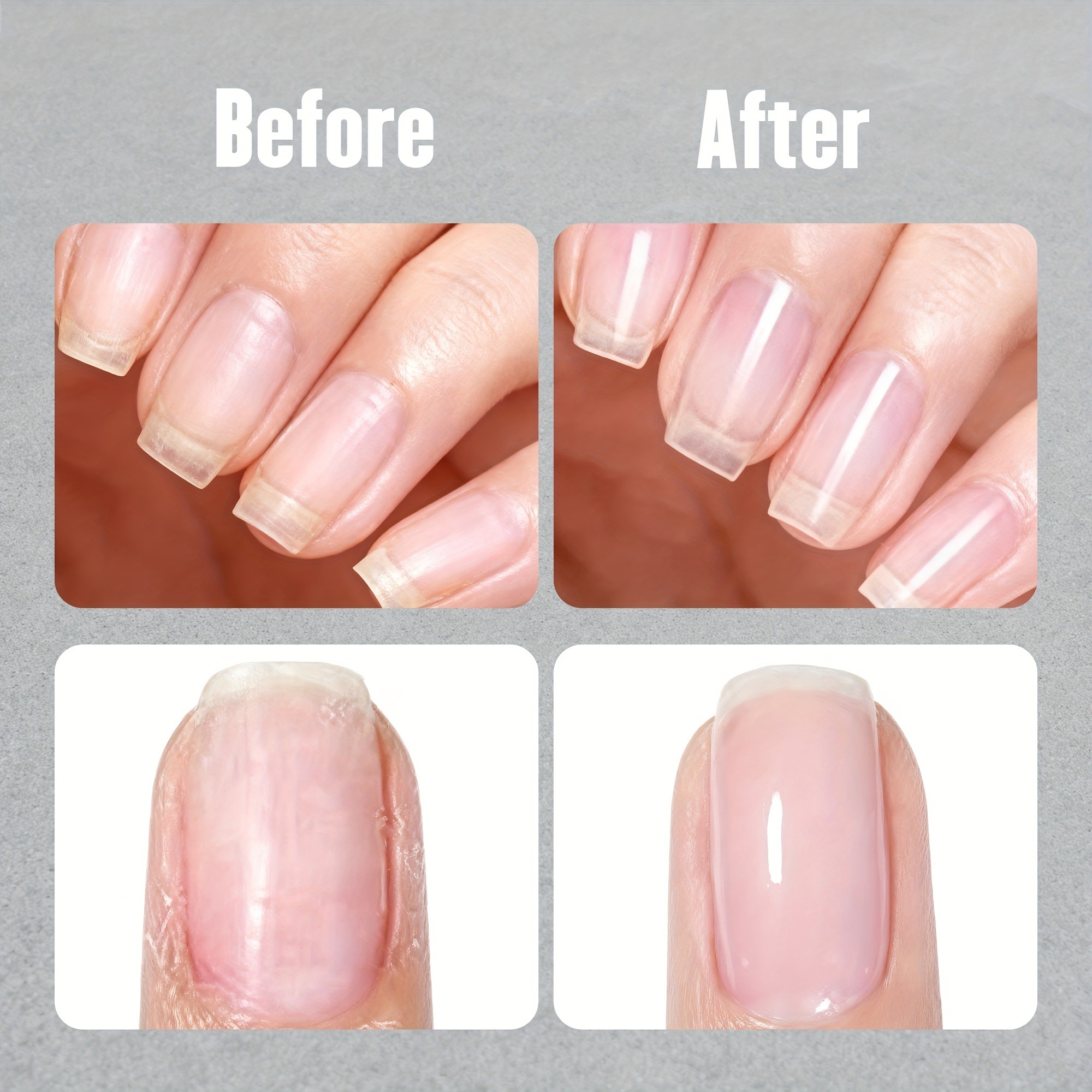 NOVAL Nail Care Set