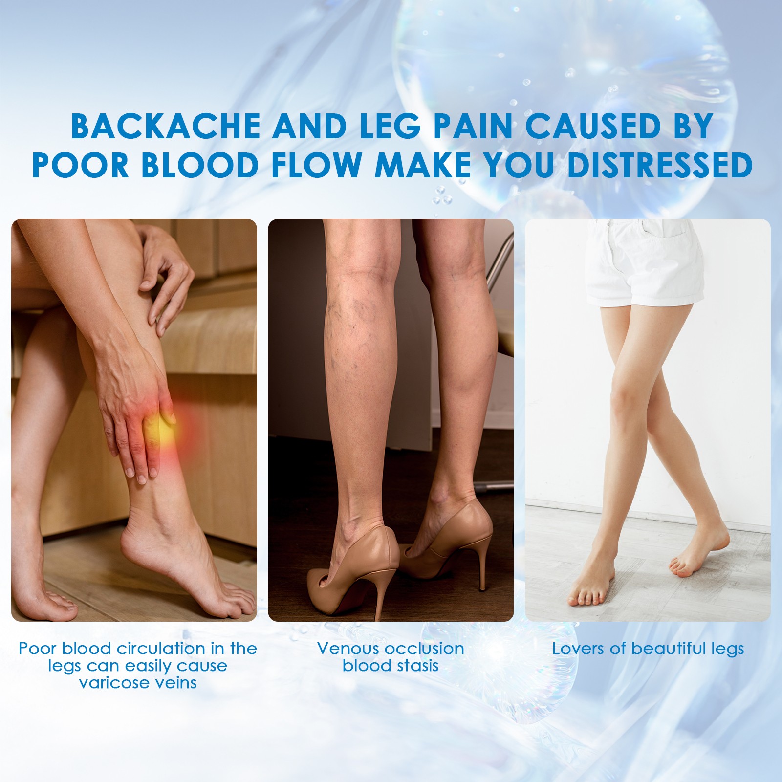 30ml Varicose Vein Spray