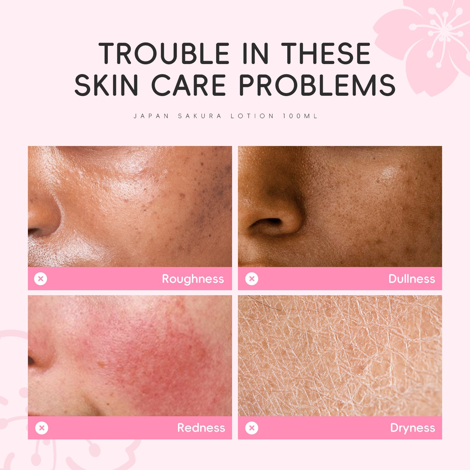 Dr. Rosva Japan Sakura Face Lotion