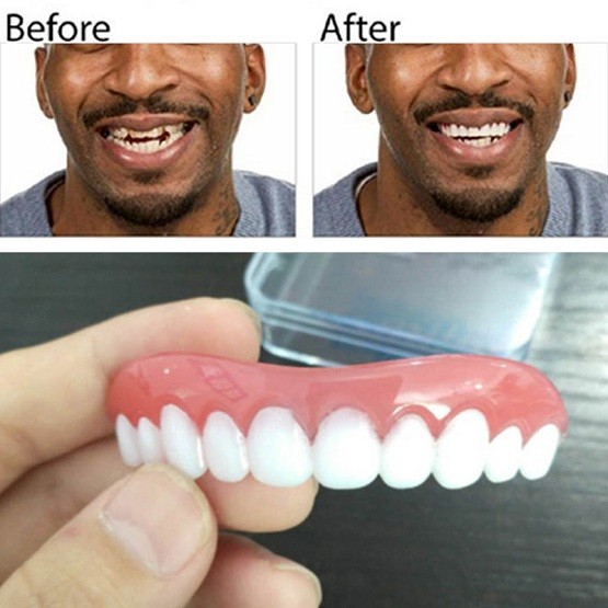 Smart Smile