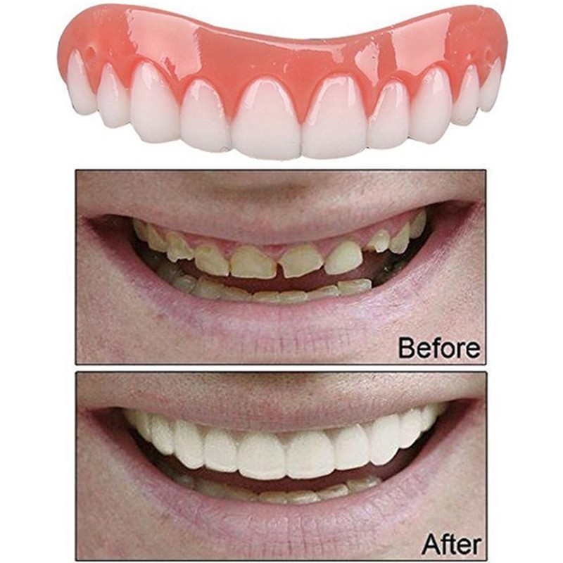Smart Smile