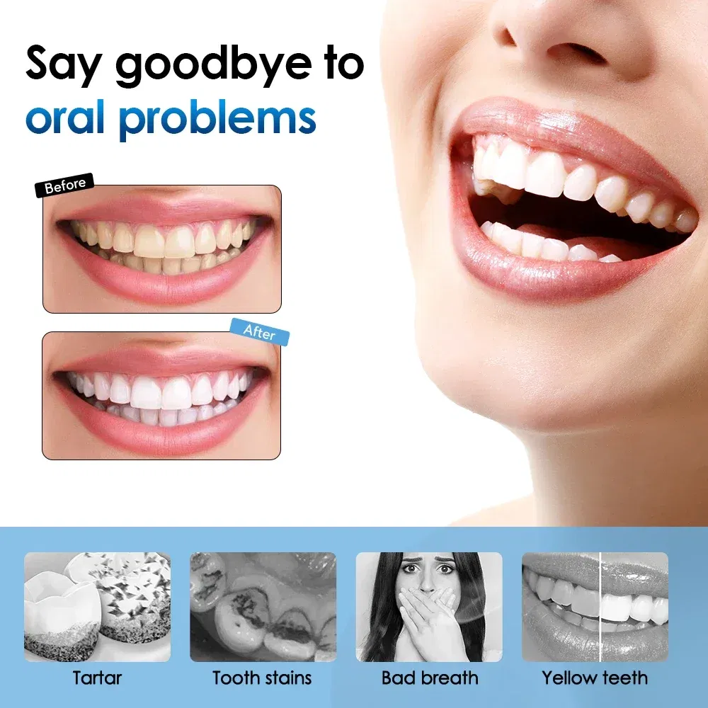 Color: black - Electric Sonic Vibration Toothbrush Dental Scaler Teeth Whitening Plaque Calculus Coffee Smoke Stains Tartar Removal Tooth Clean