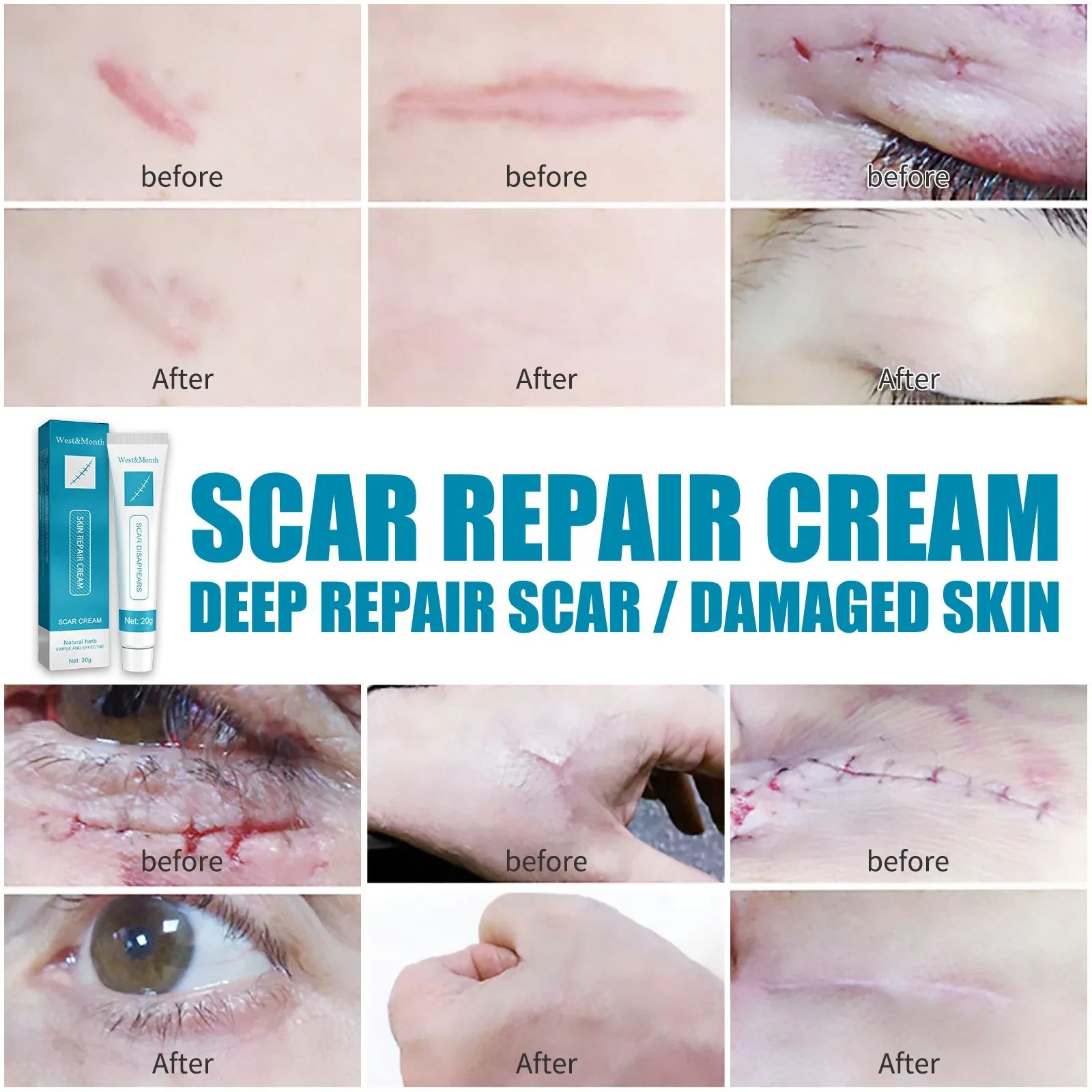 Smooth Skin Scar Repair Cream