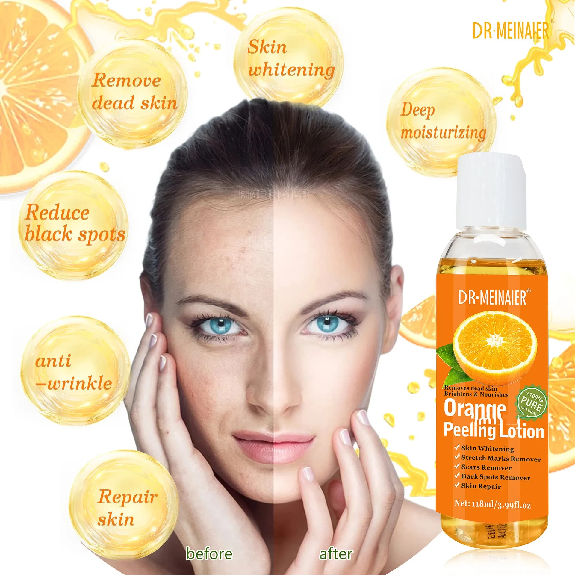 Orange Peeling Oil Remove Dead Skin