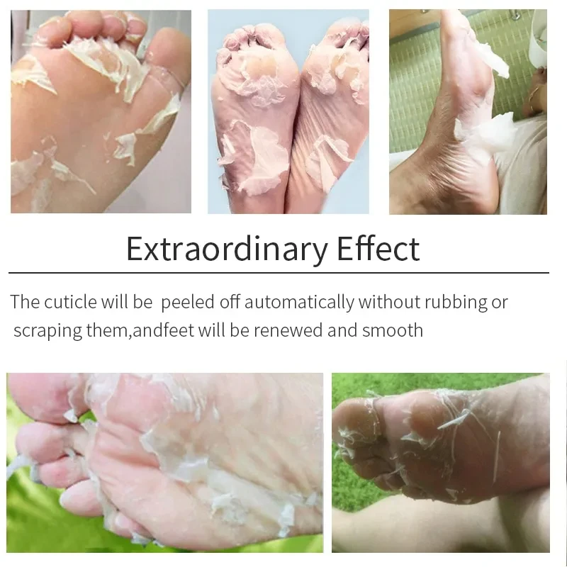 Anti Crack Heel Remove Skin Foot Patch