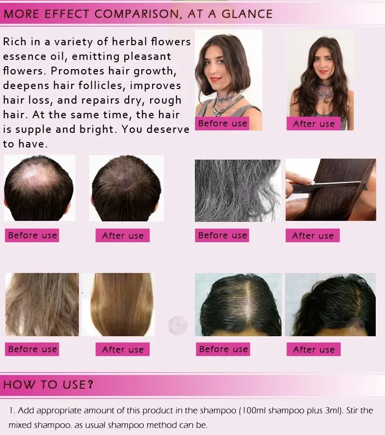 Fast Powerful Hair Growth