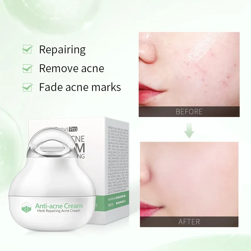 Herbal Skin lotion Moisturizing Facial Cream