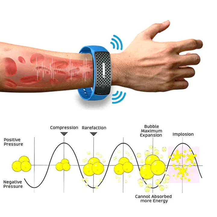 Seurico Matteo Ultrasonic Body Shape Wristband Pro