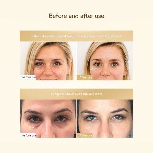 Microcurrent Gel Eye Pad Eye-beauty Instrument Accessories