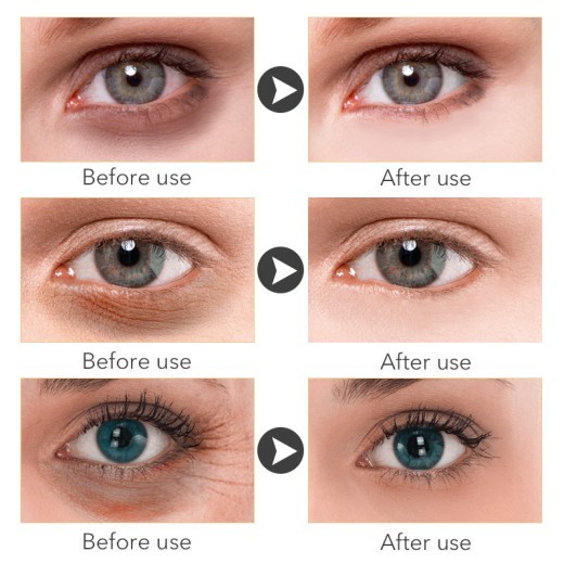 Cross-Border Vova Wrinkle Reduction Eye Cream, Fat Particles To Reduce Dark Eyes And Fine Lines, Eye Bags And Eye Cream
