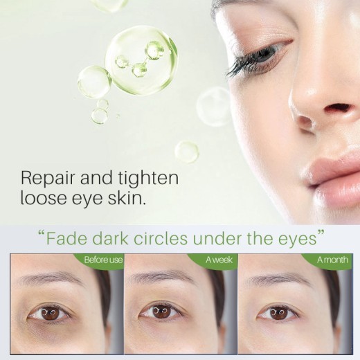 Eye Moisturizing And Fading Dark Circles