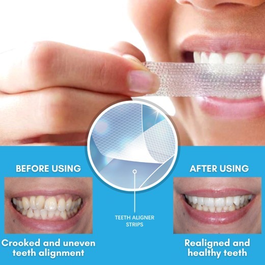 Clean Dental Plaque Cavity Beautify Dental Patches