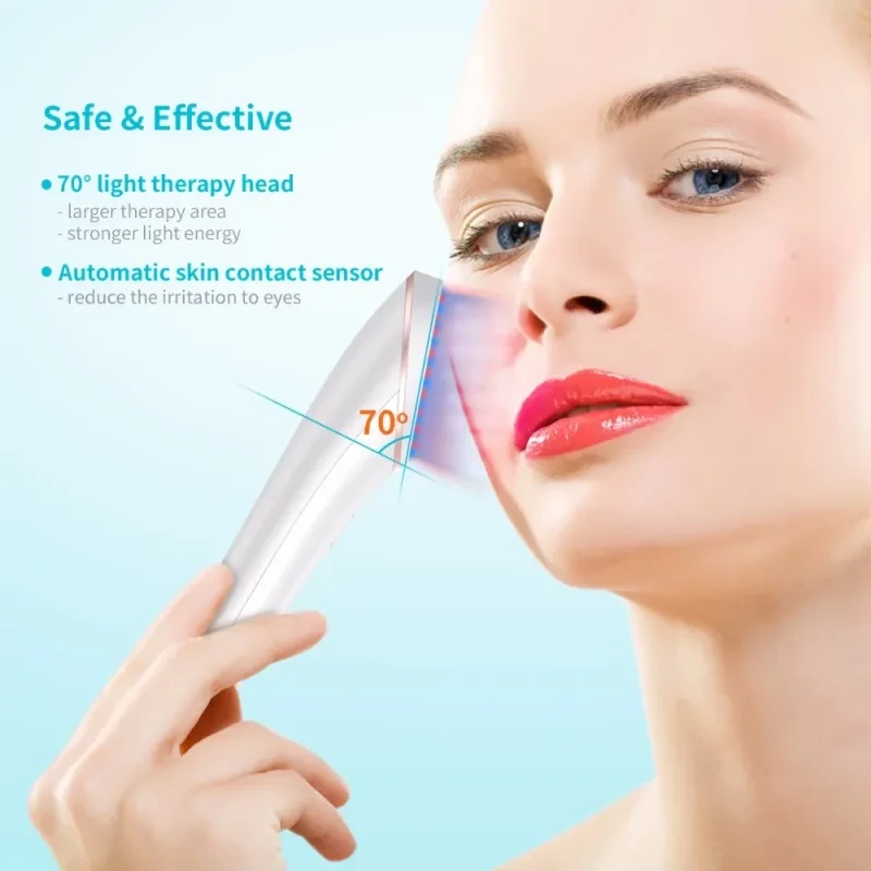 Acne Treatment Devic
