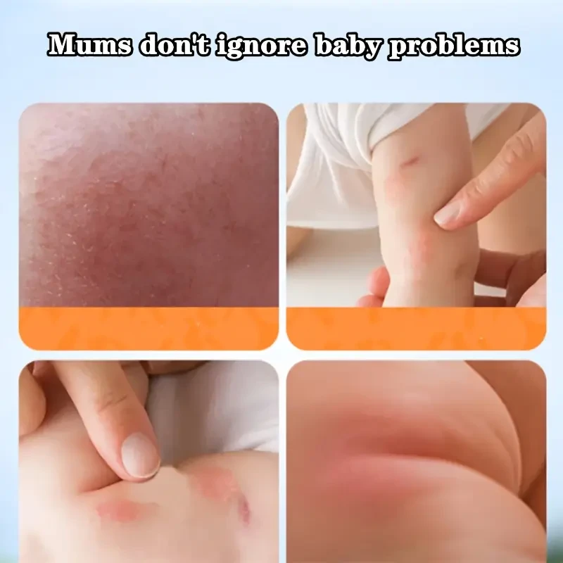 SADOER Calendula Vitamin E Full Body Moist Lotion