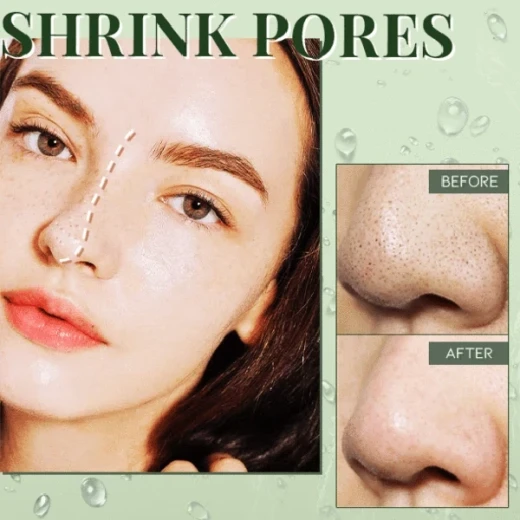 Blackhead Dissolving Gel