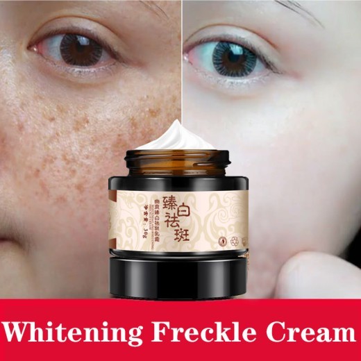 Whitening and freckle removing cream